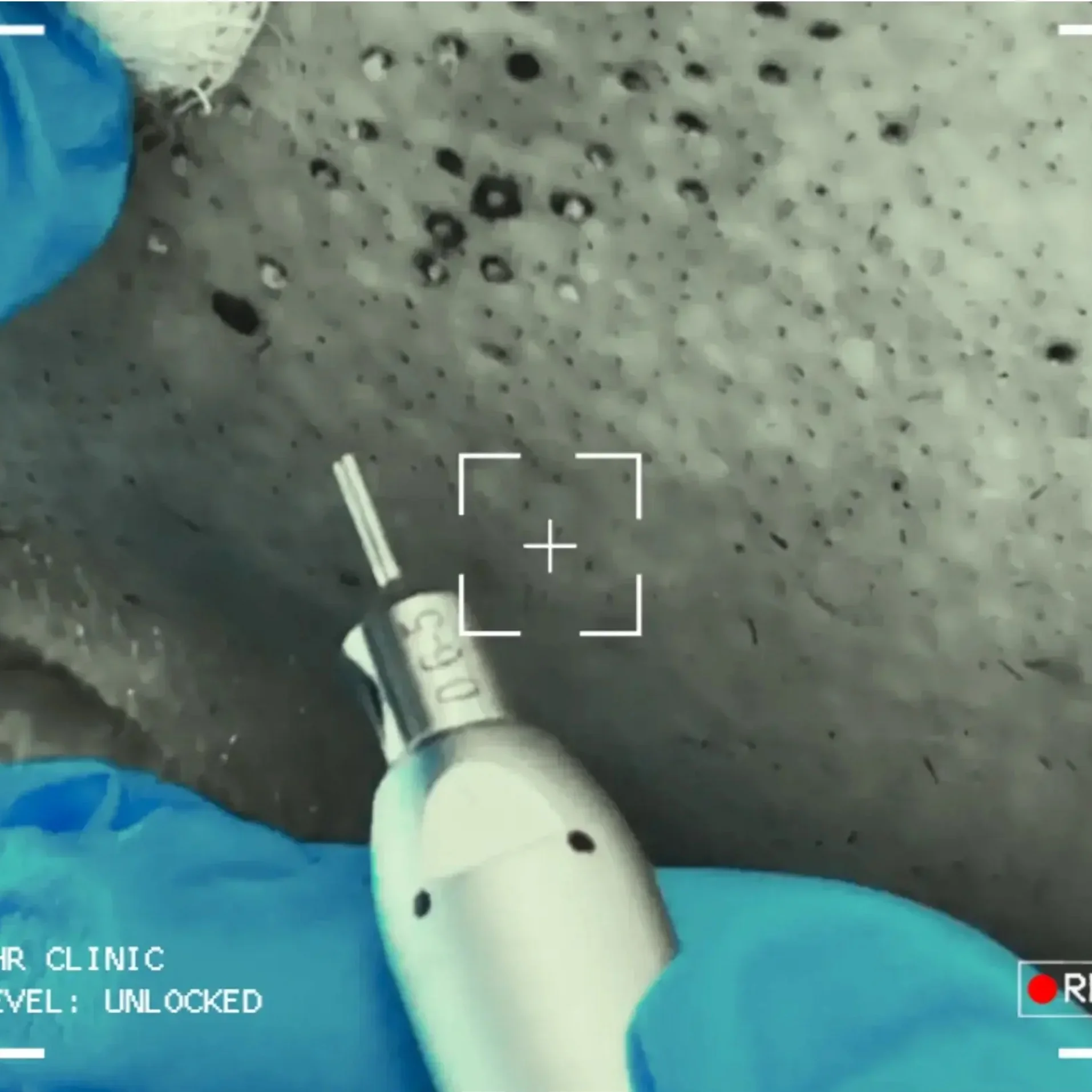 FUE ב-PHR Clinic
