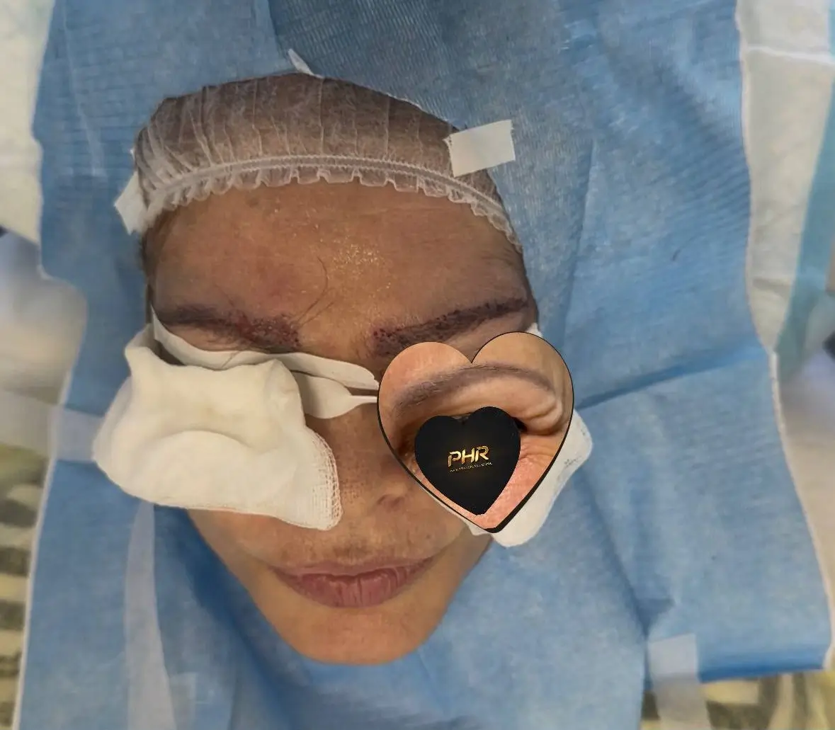 LoFT — במהלך הפעולה