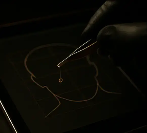 עלות השתלת שיער בישראל — ניתוח רפואי וכלכלי