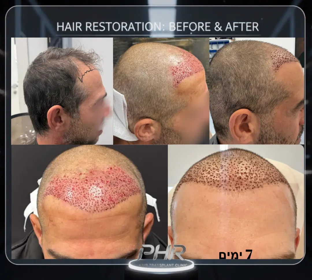 שחזור מתקדם