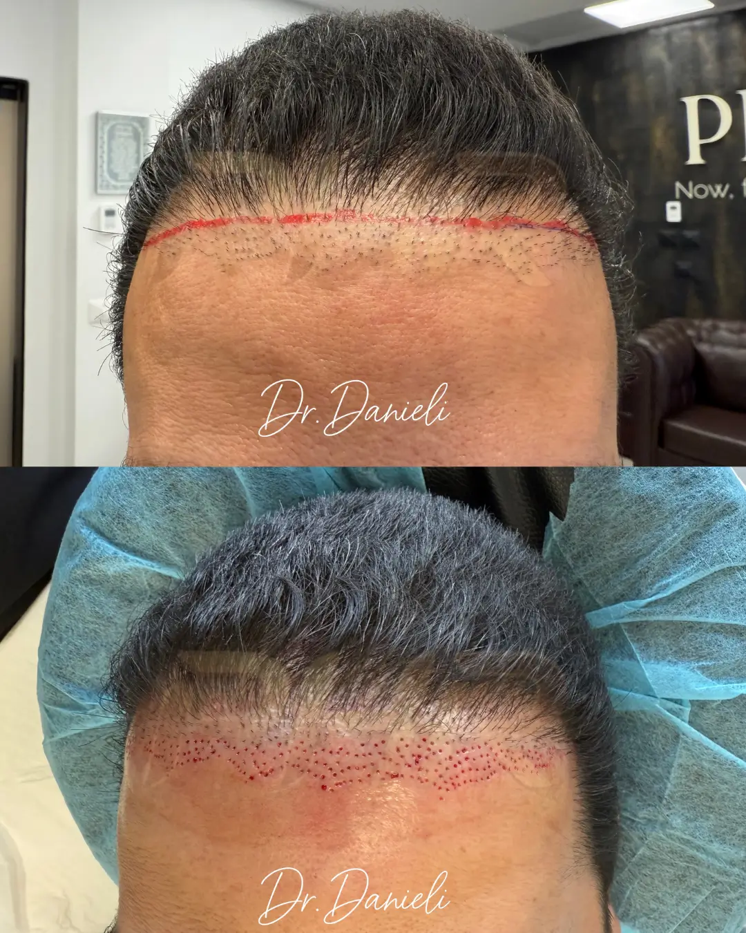 תיקון תוצאות ממרפאה אחרת