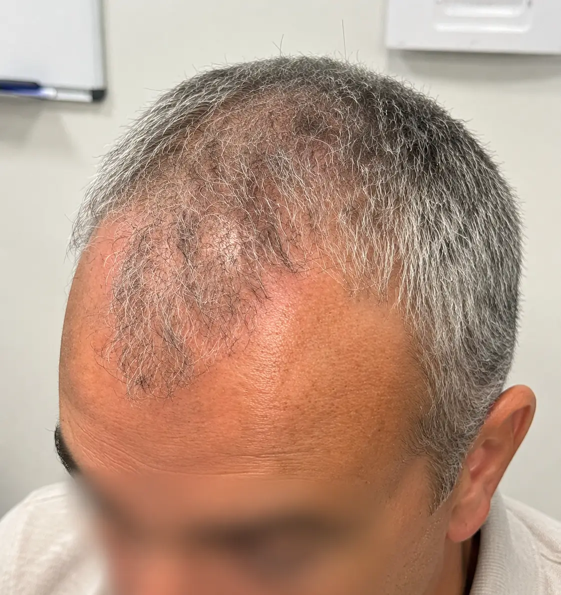 תכנון קו השיער וחלוקת אזורי העבודה